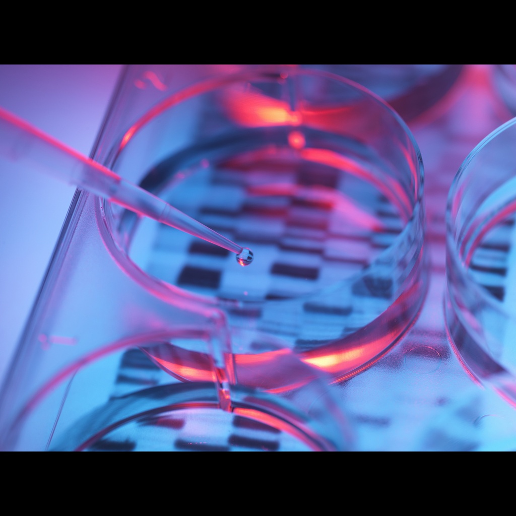 cDNA size: Human Adult Normal Tissue: Esophagus size: 40 Reactions