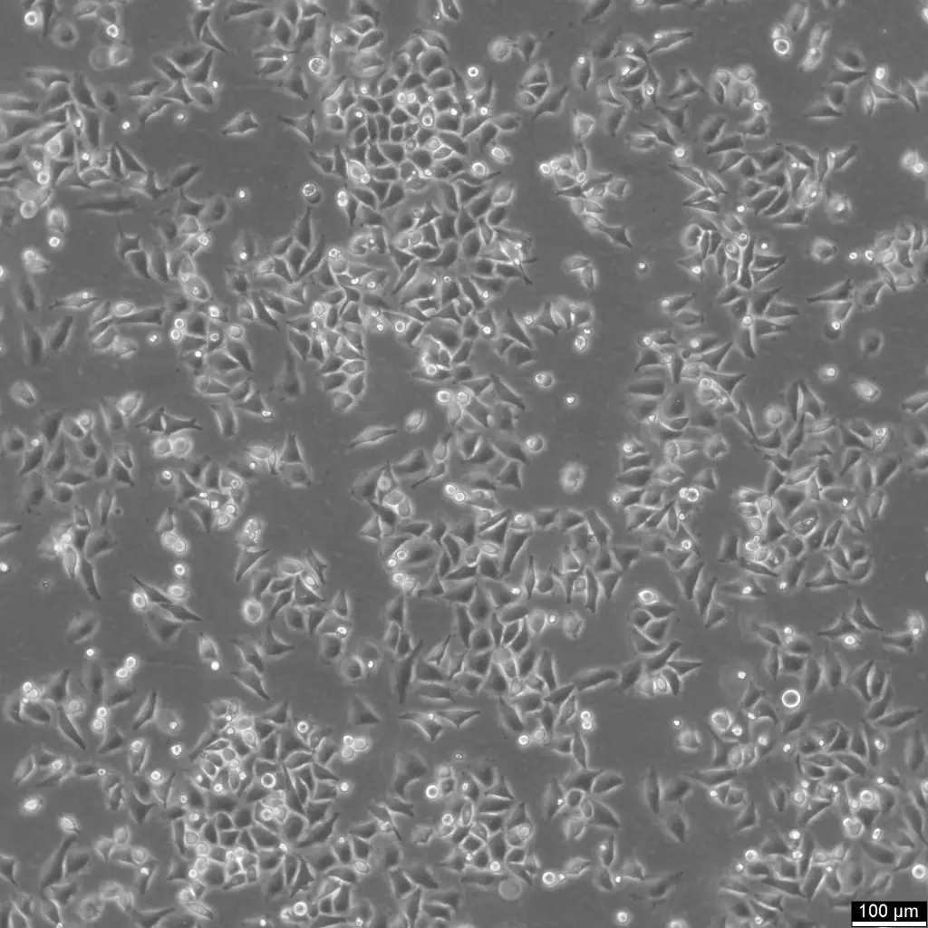 HK-CRISPR-Pom121-mCherry Cells
