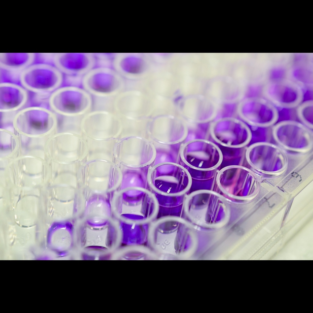 Human ILsize:38/IL1F10 ELISA Kitsize:96T